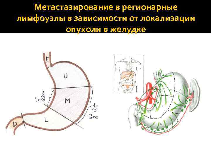 Лимфатические узлы желудка схема