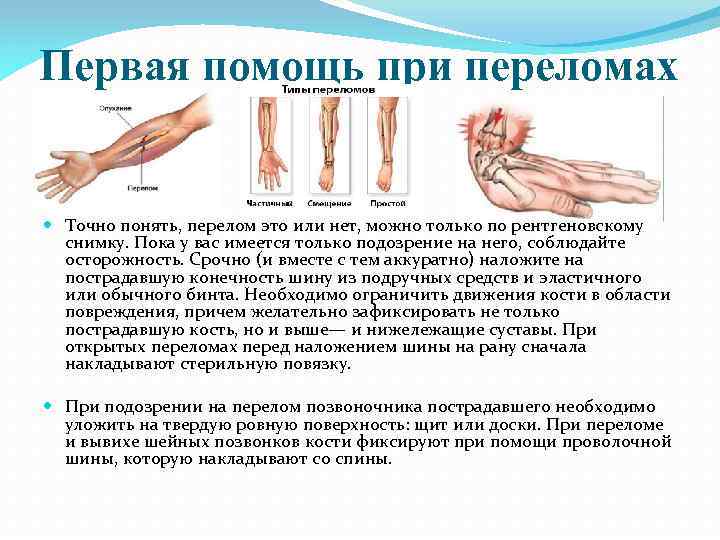 Виды перелома 1 помощь. Первая помощь при переломах. Виды переломов и первая помощь. Первая помощь при подозрении на перелом руки.