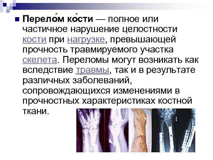 n Перело м ко сти — полное или частичное нарушение целостности кости при нагрузке,