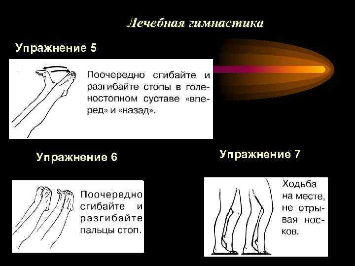 Лечебная гимнастика Упражнение 5 Упражнение 6 Упражнение 7 