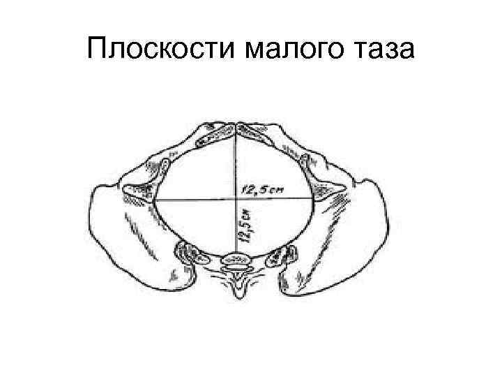 Плоскости малого таза 