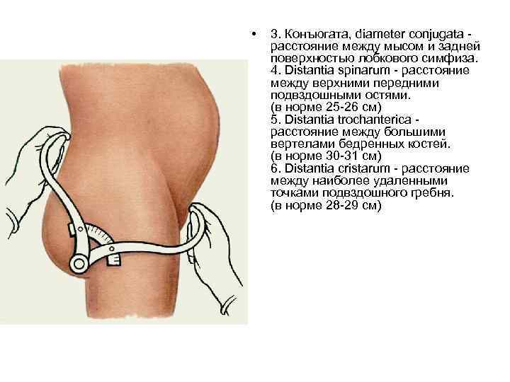  • 3. Конъюгата, diameter conjugata расстояние между мысом и задней поверхностью лобкового симфиза.