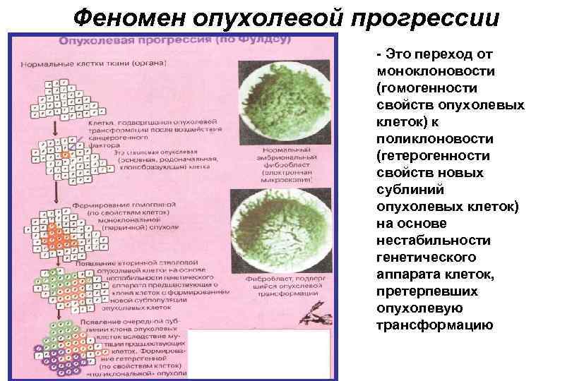 Феномен опухолевой прогрессии - Это переход от моноклоновости (гомогенности свойств опухолевых клеток) к поликлоновости