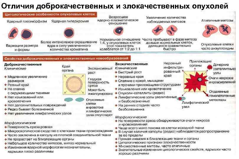 Отличия доброкачественных и злокачественных опухолей 