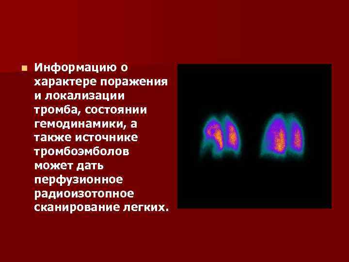 n Информацию о характере поражения и локализации тромба, состоянии гемодинамики, а также источнике тромбоэмболов