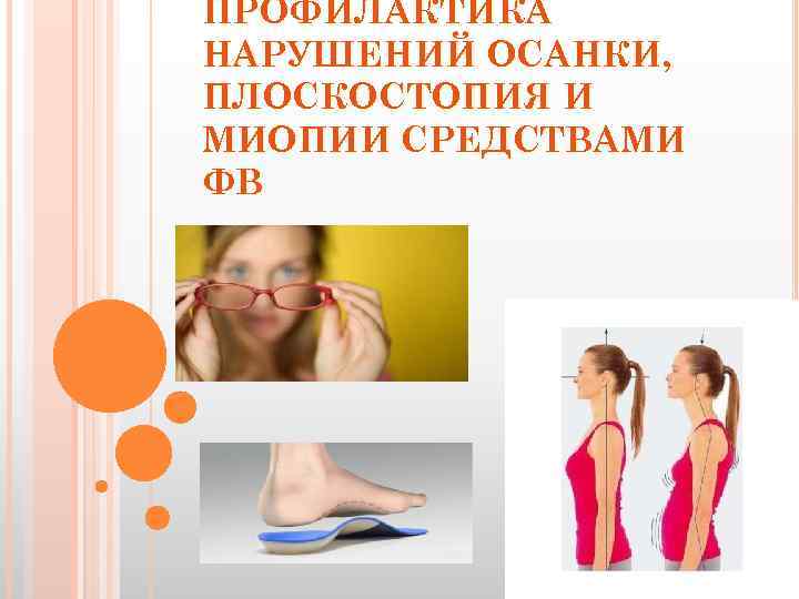 ПРОФИЛАКТИКА НАРУШЕНИЙ ОСАНКИ, ПЛОСКОСТОПИЯ И МИОПИИ СРЕДСТВАМИ ФВ 