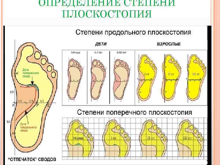 ОПРЕДЕЛЕНИЕ СТЕПЕНИ ПЛОСКОСТОПИЯ 