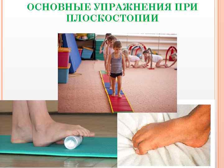 ОСНОВНЫЕ УПРАЖНЕНИЯ ПРИ ПЛОСКОСТОПИИ 