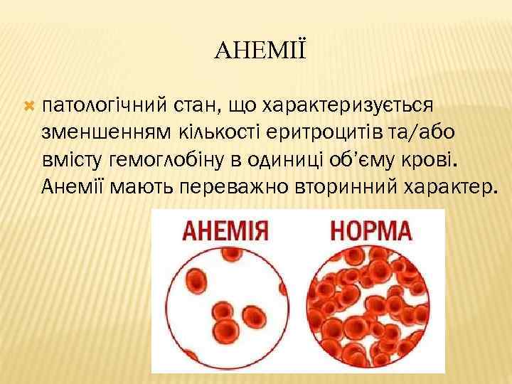 АНЕМІЇ патологічний стан, що характеризується зменшенням кількості еритроцитів та/або вмісту гемоглобіну в одиниці об’єму