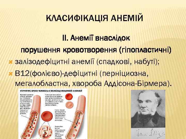 КЛАСИФІКАЦІЯ АНЕМІЙ ІІ. Анемії внаслідок порушення кровотворення (гіпопластичні) залізодефіцитні анемії (спадкові, набуті); В 12(фолієво)-дефіцитні