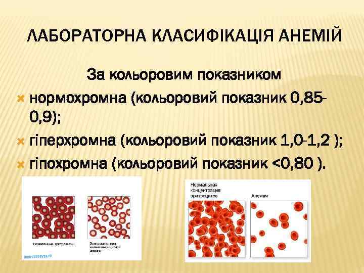 ЛАБОРАТОРНА КЛАСИФІКАЦІЯ АНЕМІЙ За кольоровим показником нормохромна (кольоровий показник 0, 850, 9); гіперхромна (кольоровий