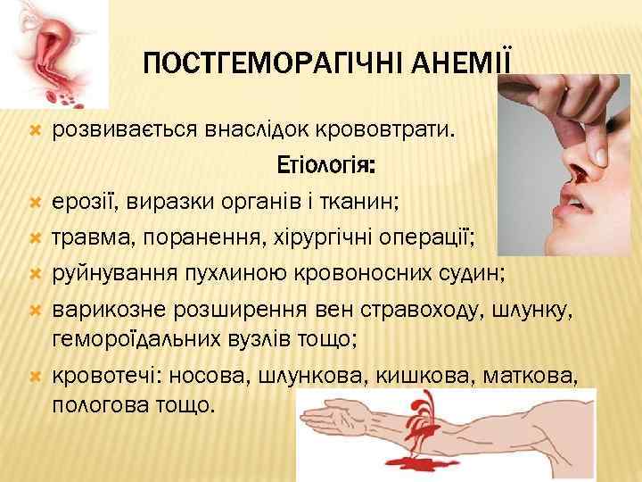 ПОСТГЕМОРАГІЧНІ АНЕМІЇ розвивається внаслідок крововтрати. Етіологія: ерозії, виразки органів і тканин; травма, поранення, хірургічні