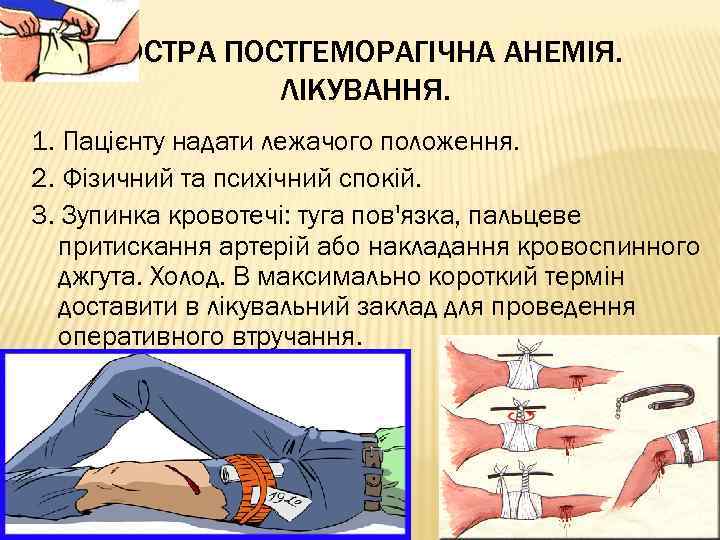 ГОСТРА ПОСТГЕМОРАГІЧНА АНЕМІЯ. ЛІКУВАННЯ. 1. Пацієнту надати лежачого положення. 2. Фізичний та психічний спокій.