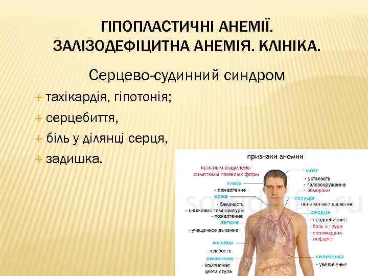 ГІПОПЛАСТИЧНІ АНЕМІЇ. ЗАЛІЗОДЕФІЦИТНА АНЕМІЯ. КЛІНІКА. Серцево-судинний синдром тахікардія, гіпотонія; серцебиття, біль у ділянці серця,