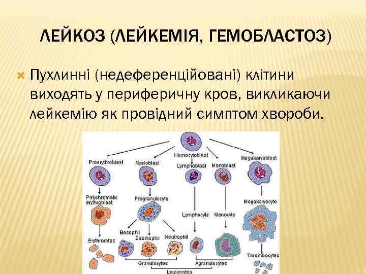 ЛЕЙКОЗ (ЛЕЙКЕМІЯ, ГЕМОБЛАСТОЗ) Пухлинні (недеференційовані) клітини виходять у периферичну кров, викликаючи лейкемію як провідний