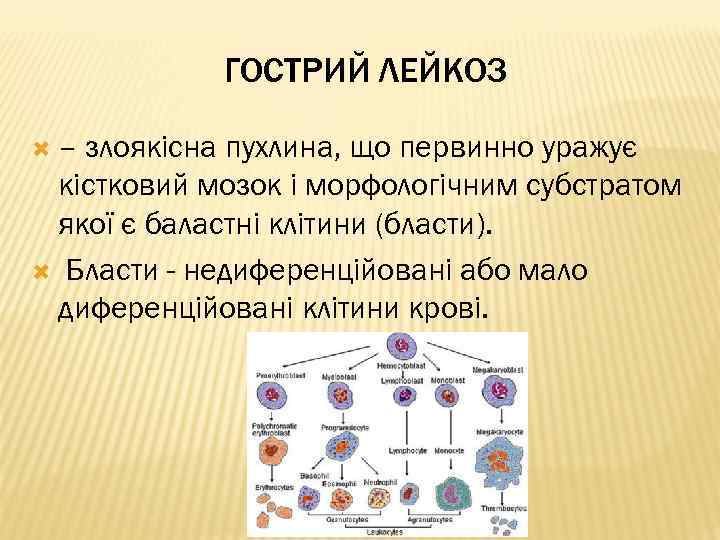 ГОСТРИЙ ЛЕЙКОЗ – злоякісна пухлина, що первинно уражує кістковий мозок і морфологічним субстратом якої