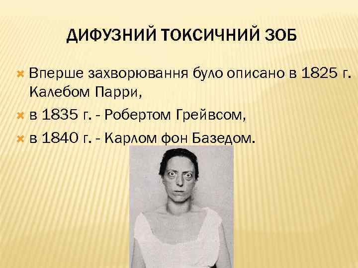 ДИФУЗНИЙ ТОКСИЧНИЙ ЗОБ Вперше захворювання було описано в 1825 г. Калебом Парри, в 1835