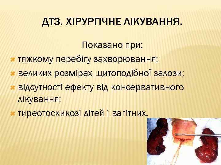 ДТЗ. ХІРУРГІЧНЕ ЛІКУВАННЯ. Показано при: тяжкому перебігу захворювання; великих розмірах щитоподібної залози; відсутності ефекту