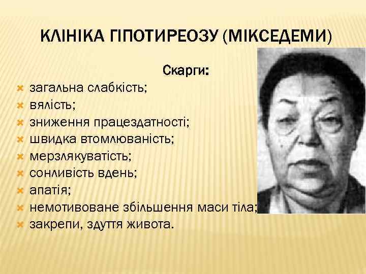 КЛІНІКА ГІПОТИРЕОЗУ (МІКСЕДЕМИ) Скарги: загальна слабкість; вялість; зниження працездатності; швидка втомлюваність; мерзлякуватість; сонливість вдень;