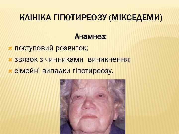 КЛІНІКА ГІПОТИРЕОЗУ (МІКСЕДЕМИ) Анамнез: поступовий розвиток; звязок з чинниками виникнення; сімейні випадки гіпотиреозу. 