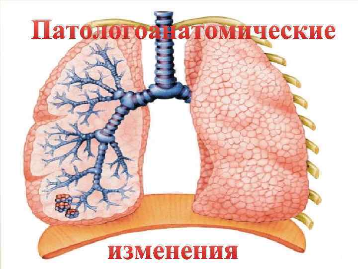 Патологоанатомические изменения 