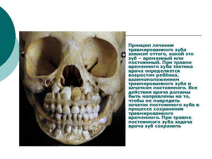 ¡ Принцип лечения травмированного зуба зависит оттого, какой это зуб – временный или постоянный.