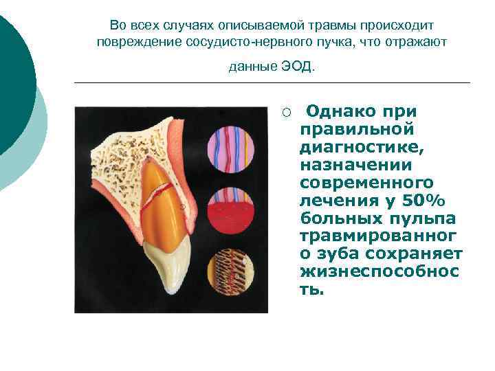 Во всех случаях описываемой травмы происходит повреждение сосудисто-нервного пучка, что отражают данные ЭОД. ¡