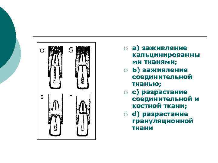 ¡ ¡ а) заживление кальцинированны ми тканями; Ь) заживление соединительной тканью; с) разрастание соединительной