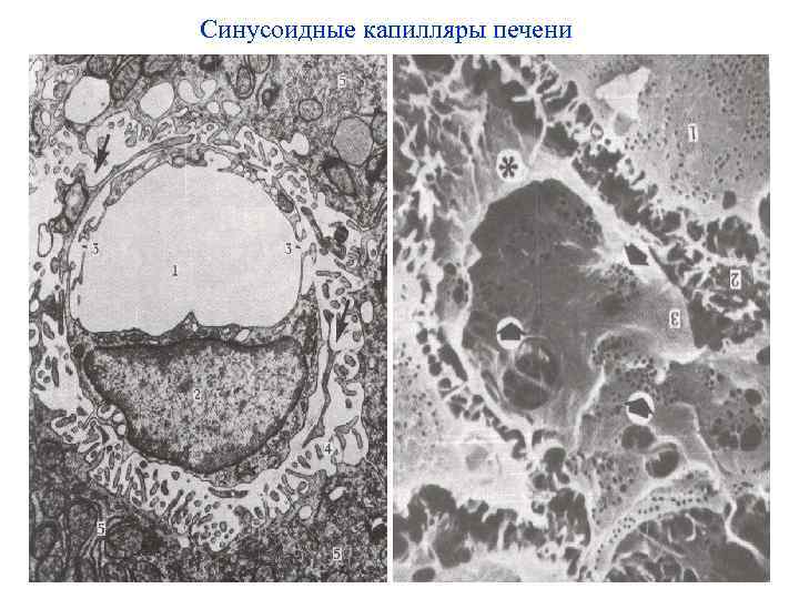 Синусоидные капилляры печени 