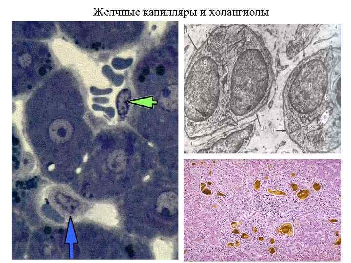 Желчные капилляры и холангиолы 