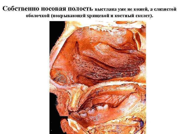 Собственно носовая полость выстлана уже не кожей, а слизистой оболочкой (покрывающей хрящевой и костный