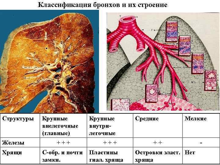 Классификация бронхов и их строение Структуры Железы Хрящи Крупные внелегочные (главные) + + +