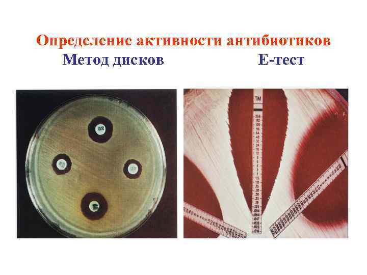 Метод е. Метод индикаторных дисков микробиология. Методы определения активности антибиотиков. Метод дисков антибиотики. Метод стандартных дисков.