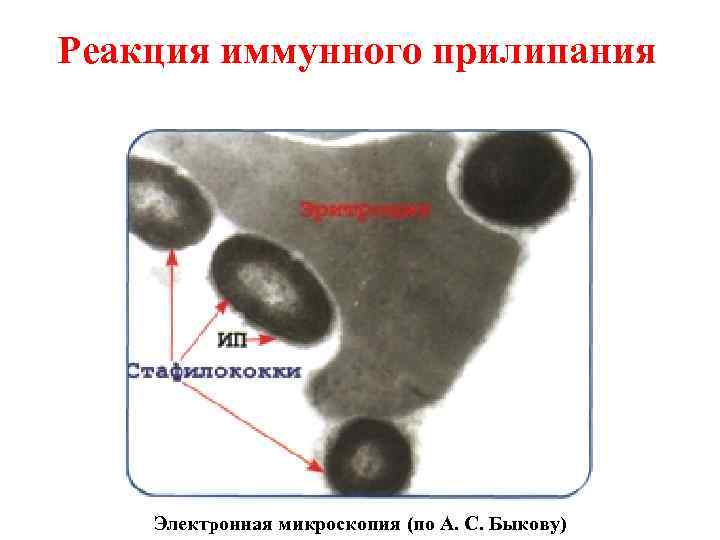 Реакция иммунного прилипания Электронная микроскопия (по А. С. Быкову) 