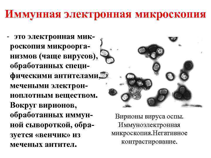 Иммунная электронная микроскопия - это электронная микроскопия микроорганизмов (чаще вирусов), обработанных специфическими антителами, мечеными