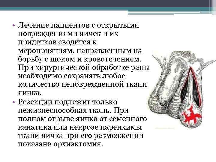  • Лечение пациентов с открытыми повреждениями яичек и их придатков сводится к мероприятиям,