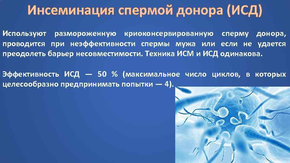 Инсеминация спермой донора (ИСД) Используют размороженную криоконсервированную сперму донора, проводится при неэффективности спермы мужа