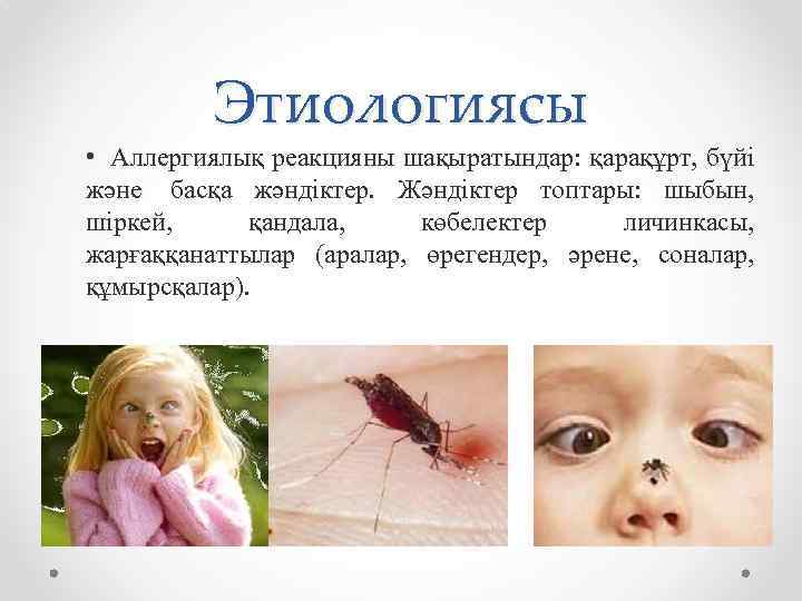 Этиологиясы • Аллергиялық реакцияны шақыратындар: қарақұрт, бүйі және басқа жәндіктер. Жәндіктер топтары: шыбын, шіркей,