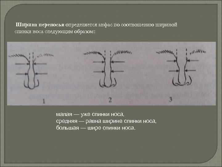 Ширина переносья определяется анфас по соотношению шириной спинки носа следующим образом: малая — уже