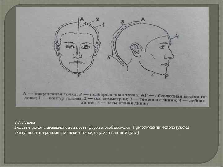 3. 2. Голова в целом описывается по высоте, форме и особенностям. При описании используются