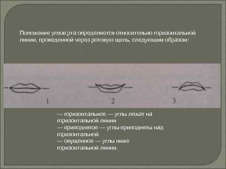 Положение углов рта определяется относительно горизонтальной линии, проведенной через ротовую щель, следующим образом: —