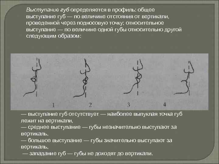 Выступание губ определяется в профиль: общее выступание губ — по величине отстояния от вертикали,