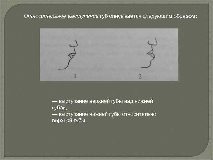 Относительное выступание губ описывается следующим образом: — выступание верхней губы над нижней губой, —