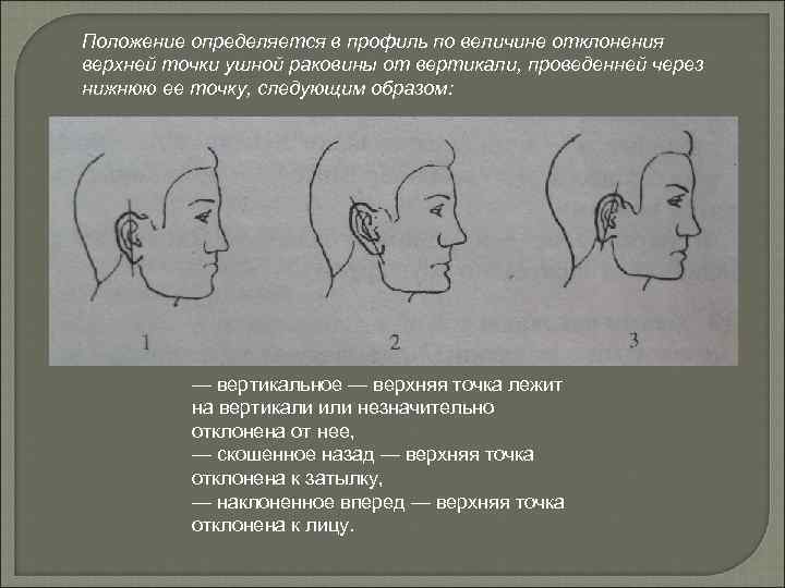 Положение определяется в профиль по величине отклонения верхней точки ушной раковины от вертикали, проведенней