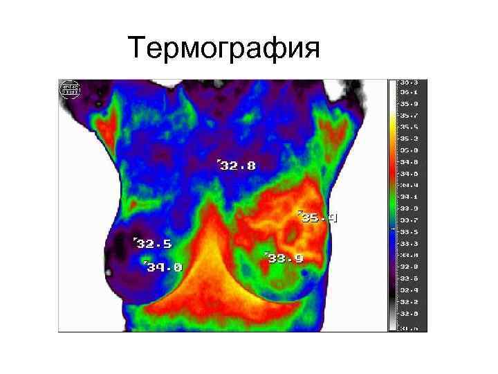 Термография 