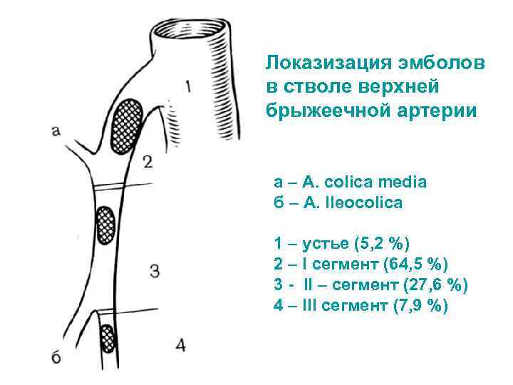 Состав эмболов схема