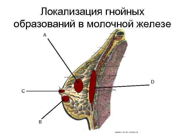 Болезни молочных желез