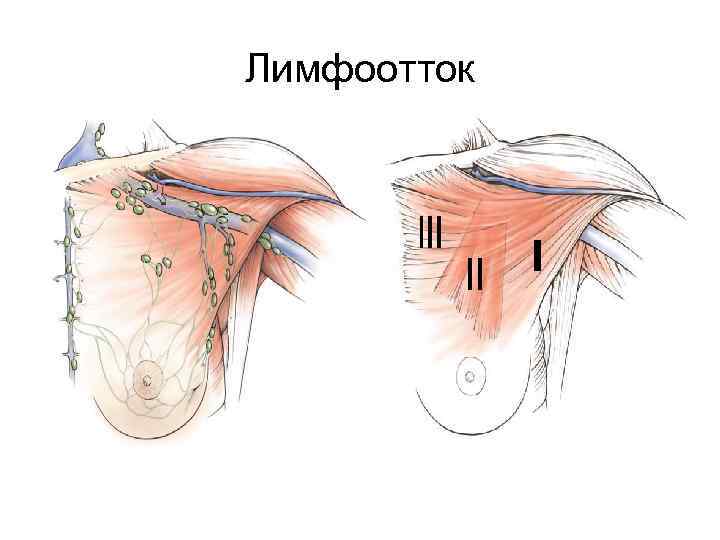 Лимфоотток 