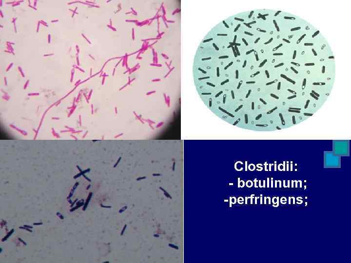 Clostridii: - botulinum; -perfringens; 