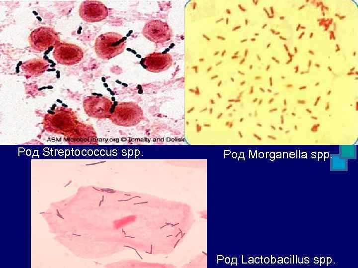 Род Streptococcus spp. Род Morganella spp. Род Lactobacillus spp. 